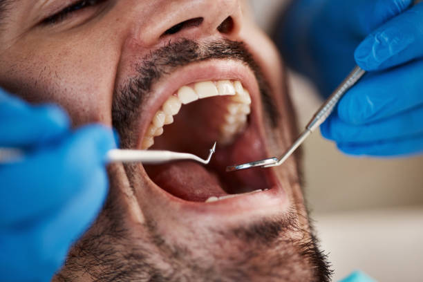 Professional Emergency Dentist in MN