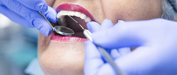 Best Emergency Wisdom Teeth Removal in Red Lake Falls, MN